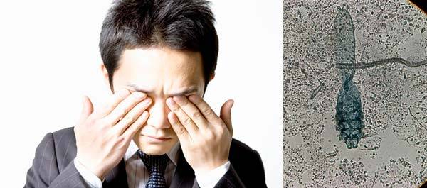 속눈썹에 사는 모낭충이 안구건조증을 유발할 수 있다는 전문가 경고가 나왔다./사진=게티이미지뱅크,클립아트코리아