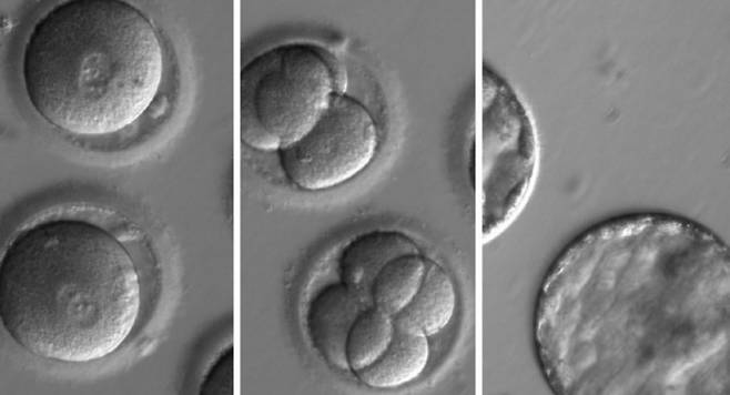 인간 배아. EPA 연합뉴스 자료사진