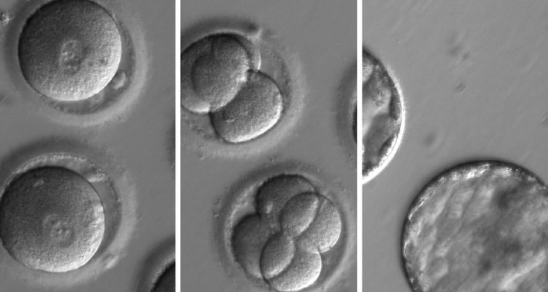 인간 배아. (사진=EPA 연합뉴스)