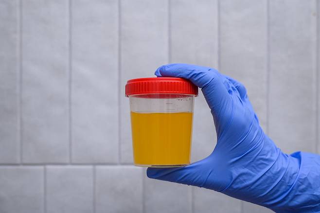 무더운 날씨에 탈수와 열사병 위험이 커져 꾸준한 수분 섭취와 체온 관리가 필수다. 적절한 예방과 신속한 응급조치, 주변 사람에 대한 관심이 온열질환 예방에 중요하다. (사진=게티이미지)