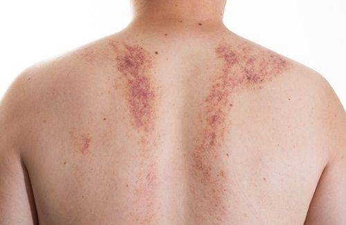 참고 사진 ⓒ게티이미지뱅크