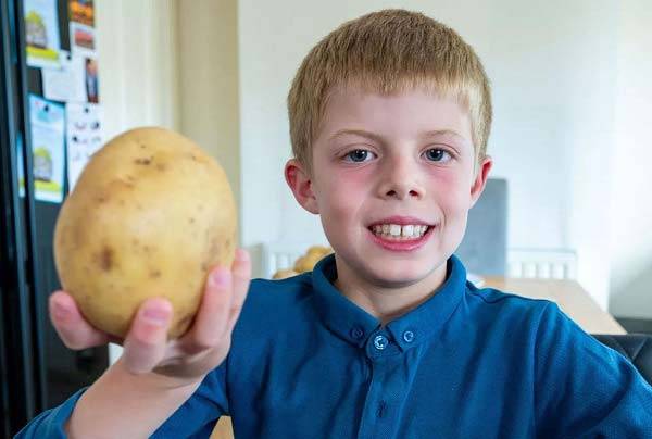 레니 사틴(8)은 생후 18개월부터 새로운 음식을 거부하며 7년간 감자만 먹었다./사진=맨체스터 이브닝 뉴스