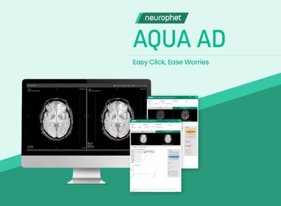 뉴로핏의 인공지능(AI) 기반 뇌 영상 검출·진단 보조 소프트웨어 ‘뉴로핏 아쿠아 AD 플러스’. 뉴로핏 제공
