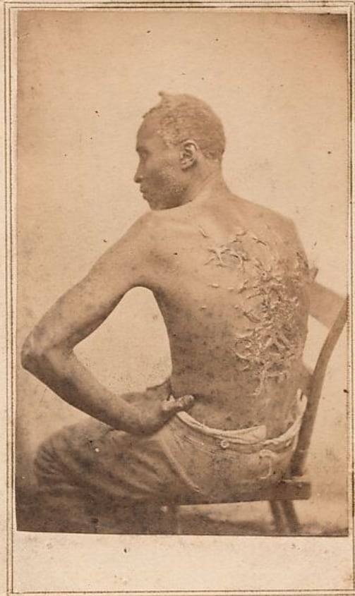 복제품 철거 지시를 받은 '채찍질 당한 등'(The Scourged Back) 사진. 노예에 대한 폭력을 적나라하게 보여주는 대표적인 사진이다. /메트로폴리탄 미술관