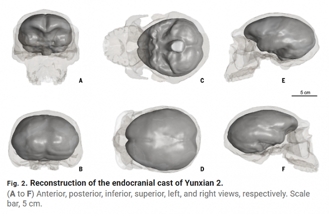 ‘운현 2’(Yunxian 2) 두개골 분석 사진. 사이언스 저널 제공