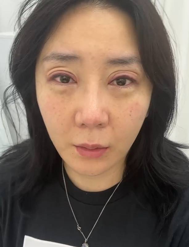 허안나 소셜 미디어