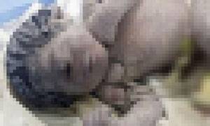 2016년에는 이집트에서 단안증을 가진 아기가 태어난 적 있는데, 알고 보니 아기 엄마가 임신한 상태에서 방사능에 노출됐다./사진=SLAATI