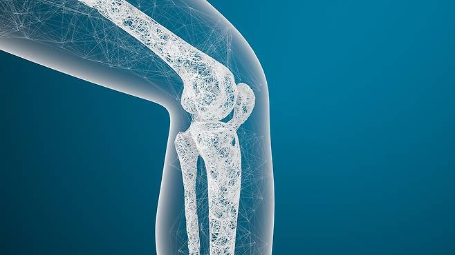 골다공증은 뼈의 밀도와 구조가 저하되어 뼈가 약해지는 만성 질환이다|출처: 클립아트코리아