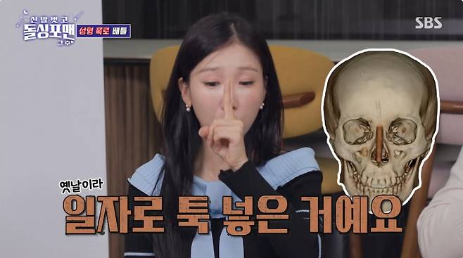 박소영이 코에 넣은 실리콘을 CT사진을 통해 공개했다. /사진=SBS '신발 벗고 돌싱포맨' 캡처