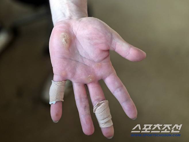 굳은살이 박인 이우성의 손바닥. 오키나와(일본)=김민경 기자