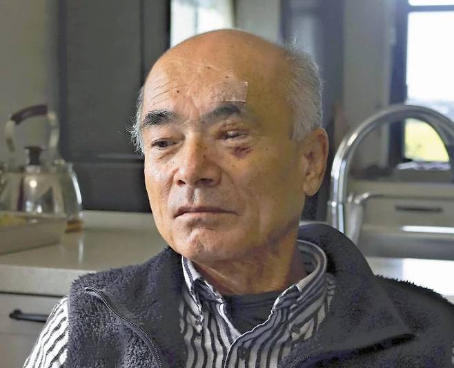 곰에 습격당해 왼쪽 눈을 사용할 수 없게 된 오카노우에 타카시씨./요미우리 신문