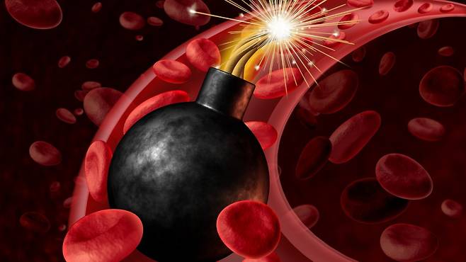 이상지질혈증은 대부분 특별한 증상이 없어 '조용한 시한폭탄'이라고 불린다|출처: 클립아트코리아