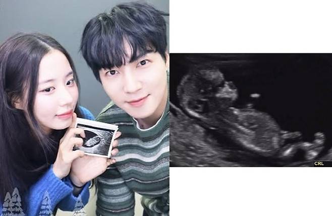 (사진=최연수 SNS)