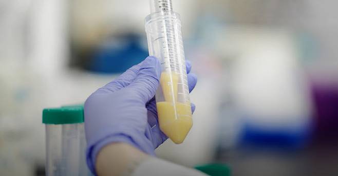 모닛셀 지방줄기세포