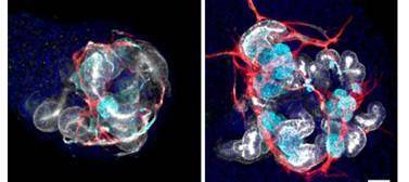 신장의 미니 장기 비교 모습. 오른쪽이 셀로이드가 배양한 것으로 혈관이나 미세 조직이 훨씬 세분화돼 있는 것을 알 수 있다. 셀로이드 제공