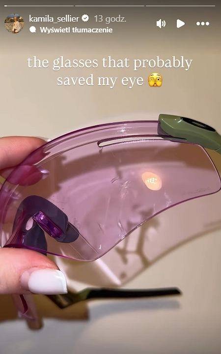 ▲ 이탈리아 밀라노 아이스스케이팅 아레나에서 열린 2026 밀라노ㆍ코르티나담페초 동계올림픽 쇼트트랙 여자 1,500m 준준결승에서 폴란드 카밀라 셀리에르는 산토스-그리즈월드의 스케이트 날에 왼쪽 눈 부위를 긁혀 출혈 증세를 보였고 한동안 일어나지 못하다가 들것에 실려나갔다. ⓒ 셀리에르 SNS