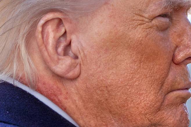 도널드 트럼프 미국 대통령이 27일(현지시각) 워싱턴 백악관 사우스론에서 마린원에 탑승하기에 앞서 기자들과 이야기하며 손을 흔들고 있다. 그의 목 부위에 붉은 기운이 보인다. 워싱턴/AP 연합뉴스