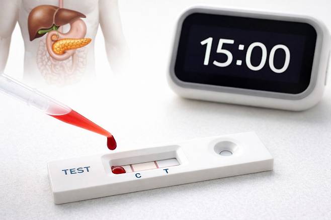 췌장암 신속 진단 검사법을 생성형 AI로 표현한 이미지 사진.