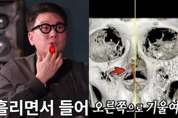 채널 ‘짠한형 신동엽’, SBS ‘미운 우리 새끼’ 캡처