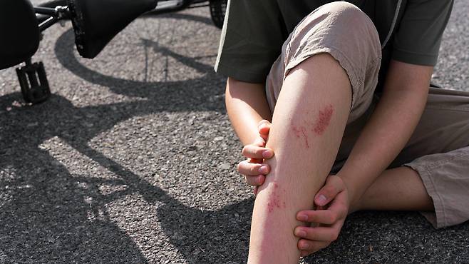 습윤 밴드는 긁히거나 까진, 얕은 상처에 효과적이다|출처: 게티이미지뱅크