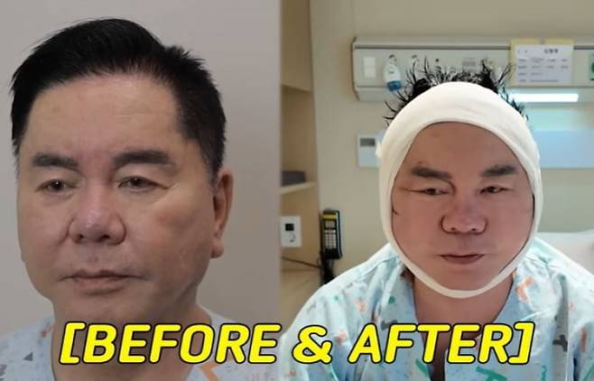 개그맨 심형래 /사진=유튜브 캡처