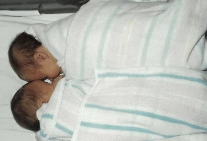 1995년 시험관 시술로 태어난 페니 샤프란스키의 쌍둥이 딸. 30년 후 유전자 검사에서 병원이 타인의 수정란을 잘못 이식했다는 사실이 밝혀졌다. 데일리메일 캡처