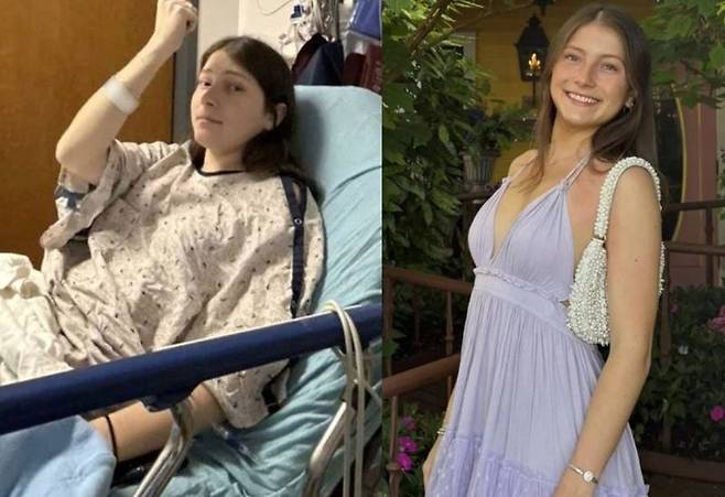 가려움과 야간 발한 등 일상적인 증상으로 시작된 이상 신호가 혈액암으로 이어진 미국 20대 대학생의 사연이 전해졌다./사진=피플