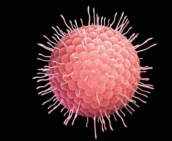 수두 대상포진 바이러스(Varicella-Zoster Virus)는 신경절에 잠복하고 있다가 인체 면역력이 떨어질 때 활동을 재개해 엄청난 통증을 유발한다. 최근 국제 학계에선 대상포진 백신이 치매까지 예방할 수 있다는 연구 결과가 잇따라 나왔다. 수십만 명을 대상으로 장기간 추적 관찰한 연구에서 백신이 대상포진은 물론 치매를 20% 줄이는 효과가 나타났다./Getty Images