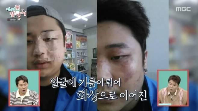 사진=MBC 예능 '전지적 참견 시점'