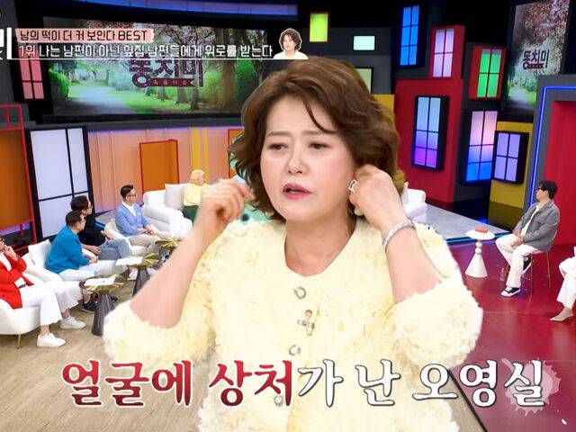 오영실이 남편이 던진 물건에 맞아 얼굴에 상처가 났었다고 고백했다. / MBN '속풀이쇼 동치미'