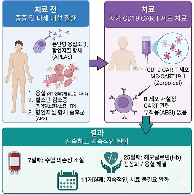 CAR-T세포를 이용한 자가면역 질환 치료./Med