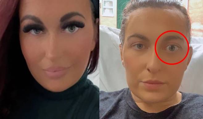 영국의 한 30대 여성이 인조 속눈썹을 제거한 뒤 뇌종양 의심 증상을 발견한 사연이 전해졌다./사진=‘더선(The Sun)’