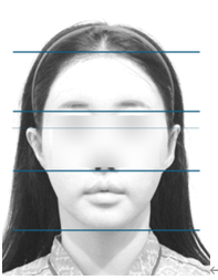 사진=슈어스 성형외과