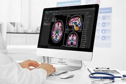 알츠하이머 치료제 분석 설루션(소프트웨어) 뉴로핏 아쿠아 AD((Neurophet AQUA AD)이미지. 업그레이드 버전인 '뉴로핏 아쿠아 AD 플러스'는 2025년 9월 국내 혁신의료기술로 선정됐으며, 2026년 1월 말 미국 식품의약국(FDA) 510(k) 시판 전 허가를 획득했다. /뉴로핏