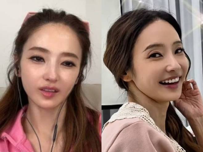 (왼쪽) 건강이상설 당시 한채영의 얼굴, (오른쪽) 지난 2일 한채영의 모습. / 사진=한채영 SNS