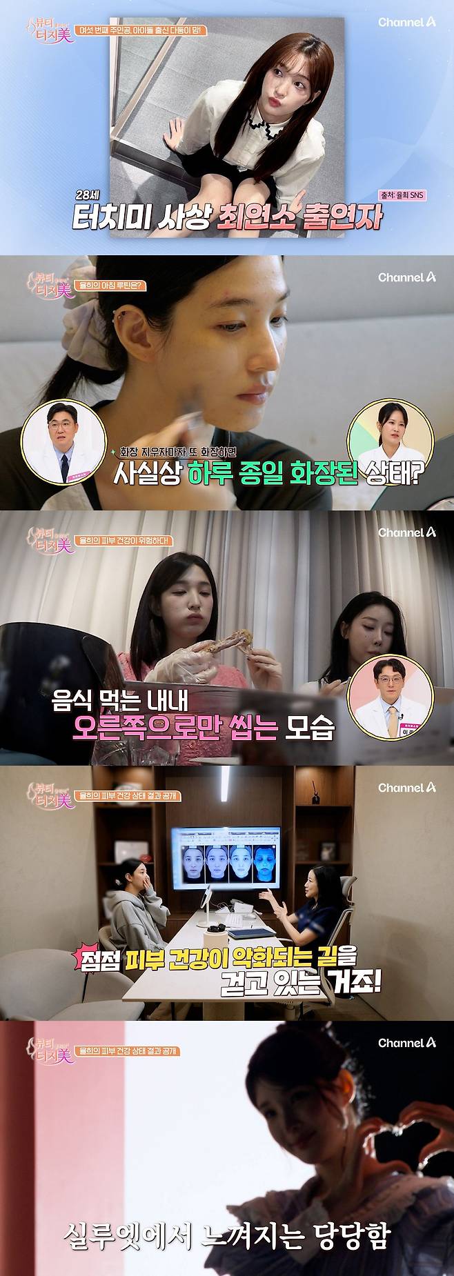 채널A '뷰티 클리닉 터치미' 6회'