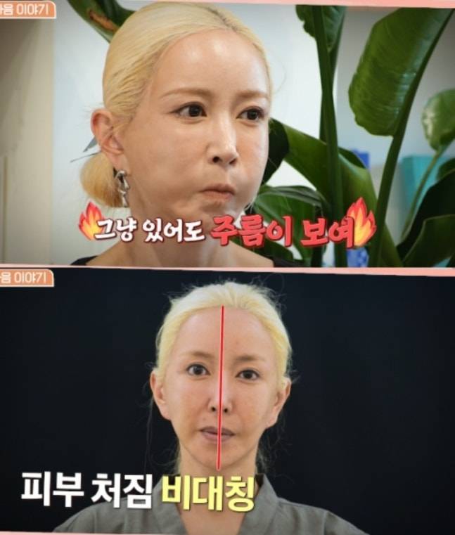 사진 | 채널A ‘뷰티클리닉 터치미’