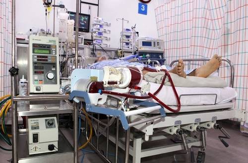 심장과 폐가 제 기능을 못할 때 사용하는 체외막산소공급 장치 에크모(ECMO) 모습 SNS 캡처 사진