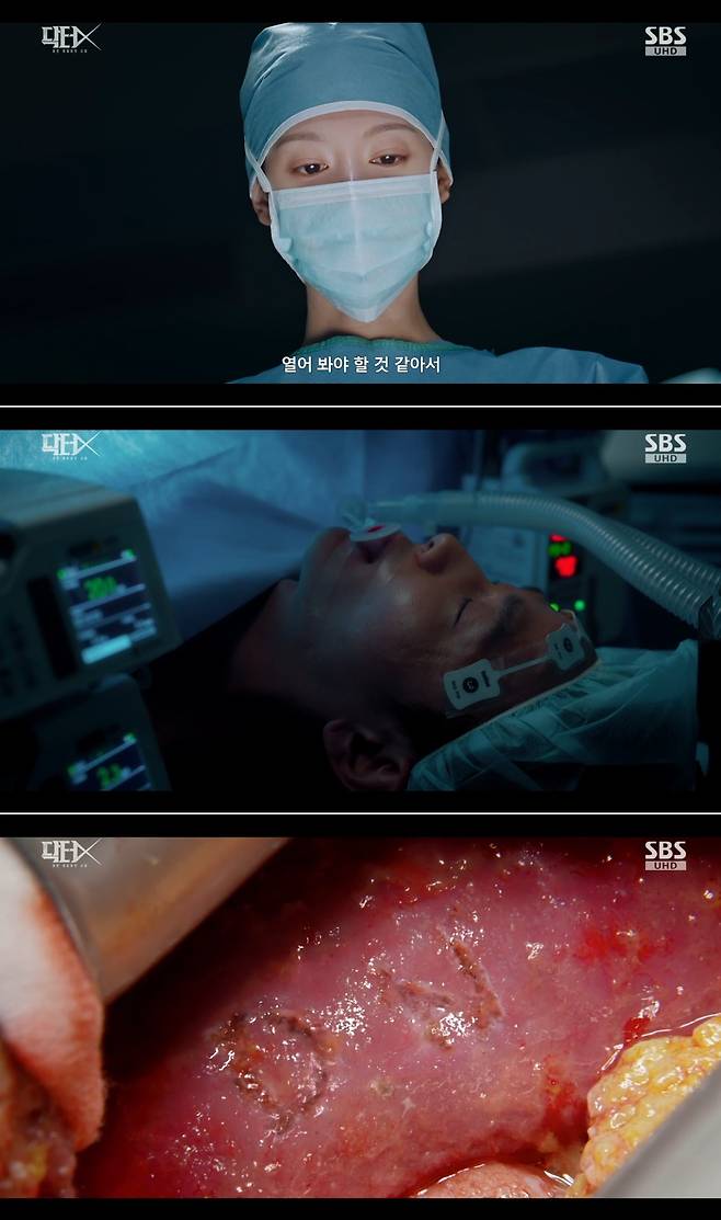 SBS 금토드라마 ‘닥터X: 하얀 마피아의 시대’ 방송 캡처