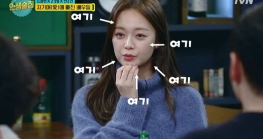 ちょん ソミン 整形