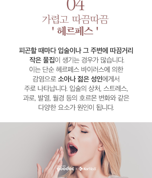 입술 각질