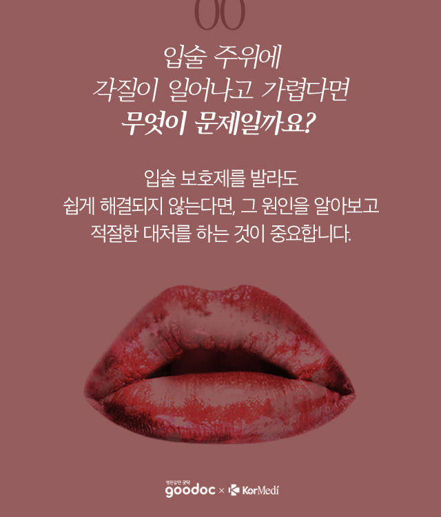 립밤을 발라도 계속 각질이 일어나는 이유