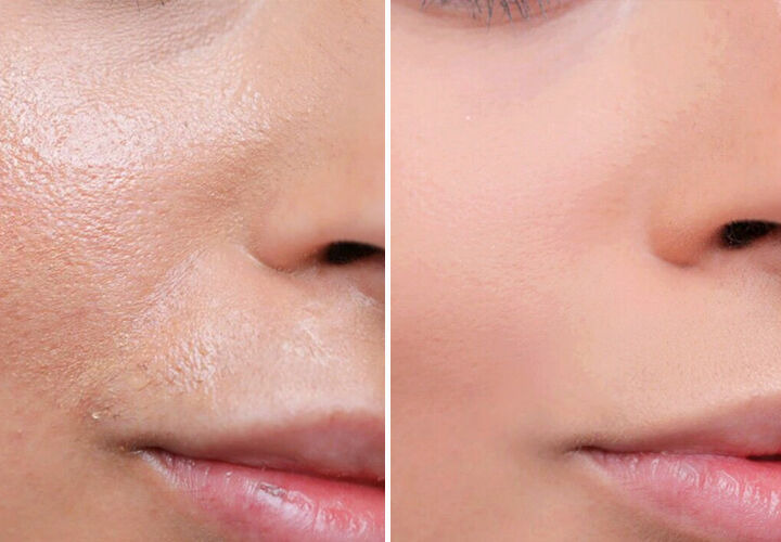 파운데이션 추천 주걱의 속건성 없이 사용법 공유! 10