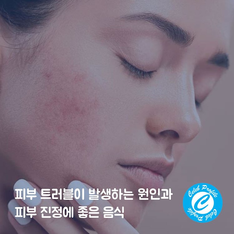 포스팅 썸네일 이미지