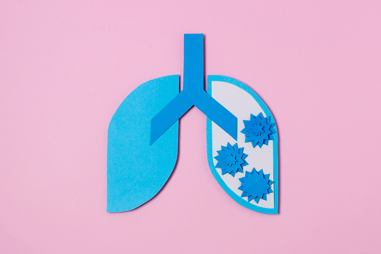 폐렴(Pneumonia), 감기와 다르다! 원인, 증상, 예방까지 총정리의 대표 이미지