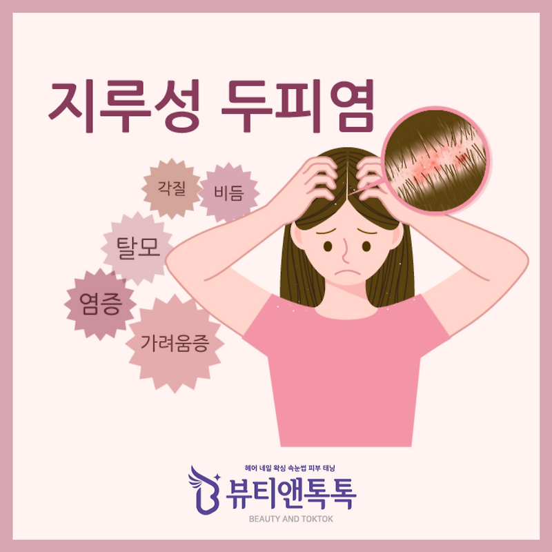 지루성 두피염 증상과 원인, 관리 방법