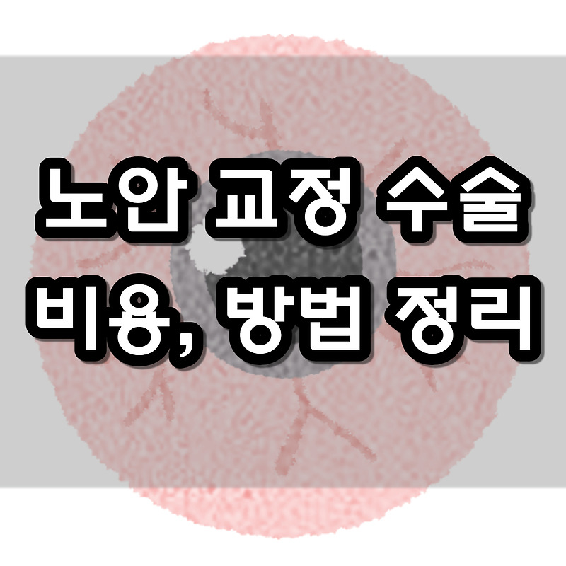 노안 교정 수술 비용을 고민하고 있다면 4