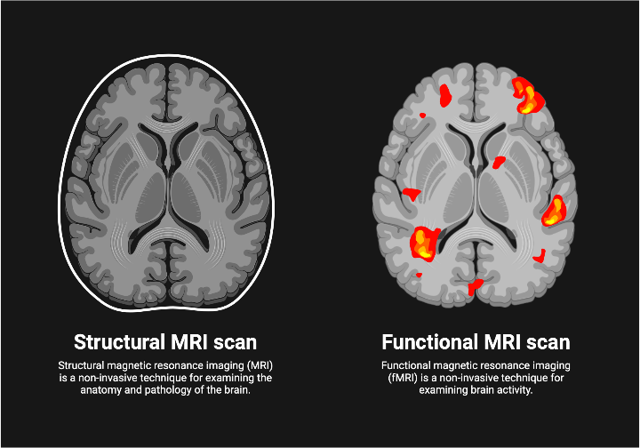 Mri ct fmri mri 