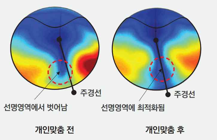 누진다초점렌즈 가격 과 종류(2) 다초점은 어지럽다던데...난?