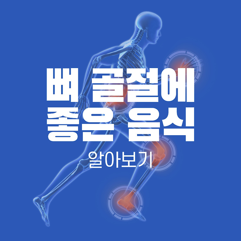 뼈골절에 좋은 음식, 나쁜 식습관 - 부러진 뼈를 빨리 붙게 하는 방법